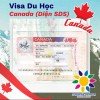 VISA DU HỌC CANADA: SUNSHINE VIETNAM CHÚC MỪNG EM ĐOÀN THỊ QUỲNH HOA ĐƯỢC CẤP VISA DU HỌC CANADA DIỆN SDS – KHÔNG CHỨNG MINH TÀI CHÍNH VỚI IELTS 6.0 (Không yêu cầu điểm từng kỹ năng phải 6.0)