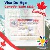 VISA DU HỌC CANADA: SUNSHINE VIETNAM CHÚC MỪNG EM NGUYỄN THỊ ÁNH NGỌC ĐÃ ĐƯỢC CẤP VISA DU HỌC CANADA DIỆN SDS – KHÔNG CHỨNG MINH TÀI CHÍNH VỚI IELTS 6.0 (Không yêu cầu điểm từng kỹ năng phải 6.0)